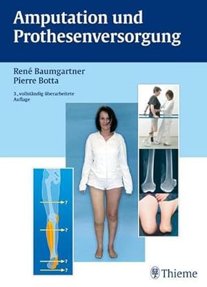 Seller image for Amputation und Prothesenversorgung : Indikationsstellung, operative Technik, Nachbehandlung, Funktionstraining, Rehabilitation for sale by AHA-BUCH