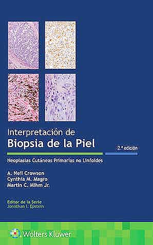 Bild des Verkufers fr Interpretacin de Biopsias de la Piel. Neoplasias Cutneas Primarias no Linfoides zum Verkauf von Vuestros Libros