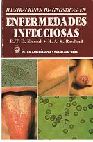 Seller image for Ilustraciones Diagnosticas En Enfermedades Infecciosas for sale by lisarama