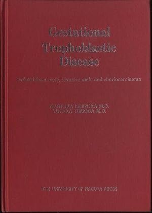 Gestational Trophoblastic Disease Hydatidiform Mole, Invasive Mole and Choriocarcinoma by Naotaka...
