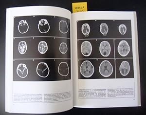 Imagen del vendedor de Zerebrale Computer-Tomographie. a la venta por Augusta-Antiquariat GbR
