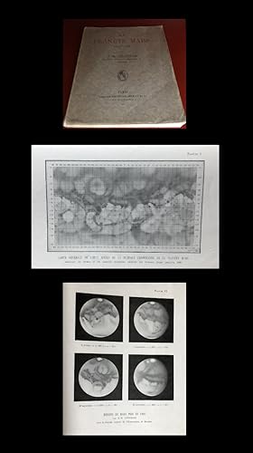 La Planete Mars. Etude basee sur les resultats obtenus avec la grande lunette de l'Observatoire d...