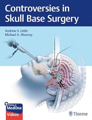 Bild des Verkufers fr Controversies in Skull Base Surgery zum Verkauf von AHA-BUCH