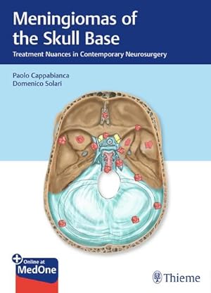 Seller image for Meningiomas of the Skull Base: Treatment Nuances in Contemporary Neurosurgery : Treatment Nuances in Contemporary Neurosurgery for sale by AHA-BUCH