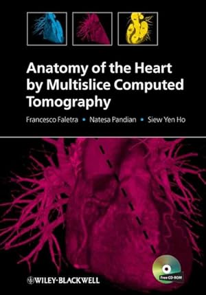 Seller image for Anatomy of the Heart by Multislice Computed Tomography for sale by GreatBookPricesUK