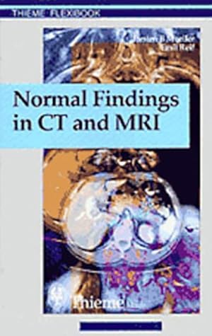 Seller image for Normal Findings in CT and MRI for sale by GreatBookPricesUK