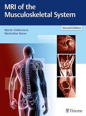 Image du vendeur pour MRI of the Musculoskeletal System mis en vente par GreatBookPricesUK