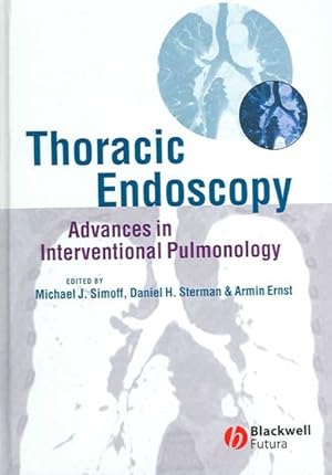 Seller image for Thoracic Endoscopy : Advances in Interventional Pulmonology for sale by GreatBookPricesUK