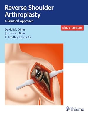 Seller image for Reverse Shoulder Arthroplasty : A Practical Approach for sale by GreatBookPricesUK