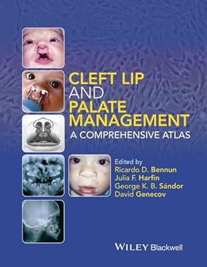 Immagine del venditore per Cleft Lip and Palate Management : A Comprehensive Atlas venduto da GreatBookPricesUK