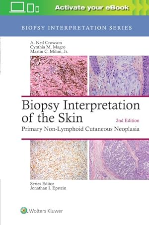 Bild des Verkufers fr Biopsy Interpretation of the Skin : Primary Non-lymphoid Cutaneous Neoplasia zum Verkauf von GreatBookPricesUK