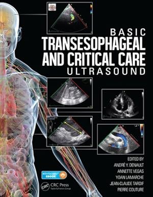 Bild des Verkufers fr Basic Transesophageal and Critical Care Ultrasound zum Verkauf von GreatBookPricesUK