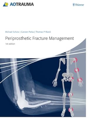 Seller image for Periprosthetic Fracture Management for sale by GreatBookPricesUK