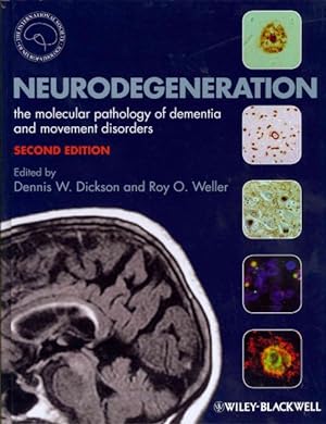 Bild des Verkufers fr Neurodegeneration : The Molecular Pathology of Dementia and Movement Disorders zum Verkauf von GreatBookPricesUK
