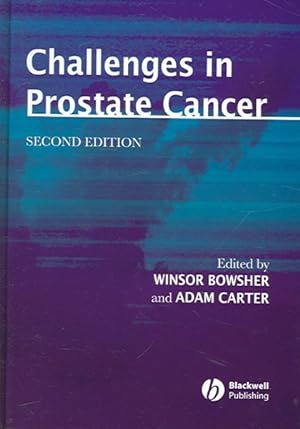 Bild des Verkufers fr Challenges In Prostate Cancer zum Verkauf von GreatBookPricesUK