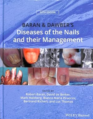 Immagine del venditore per Baran & Dawber's Diseases of the Nails and their Management venduto da GreatBookPricesUK