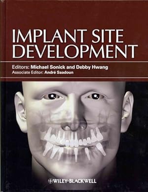 Imagen del vendedor de Implant Site Development a la venta por GreatBookPricesUK