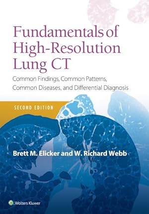 Imagen del vendedor de Fundamentals of High-Resolution Lung CT : Common Findings, Common Patterns, Common Diseases and Differential Diagnosis a la venta por GreatBookPricesUK