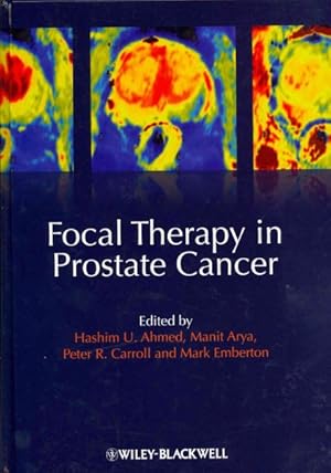 Seller image for Focal Therapy in Prostate Cancer for sale by GreatBookPricesUK