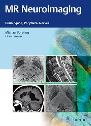 Seller image for MR Neuroimaging : Brain, Spine, Peripheral Nerves for sale by GreatBookPricesUK