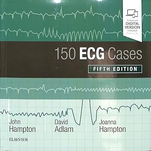 Seller image for 150 ECG Cases for sale by GreatBookPricesUK