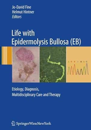 Immagine del venditore per Life With Epidermolysis Bullosa Eb : Etiology, Diagnosis, Multidisciplinary Care and Therapy venduto da GreatBookPricesUK