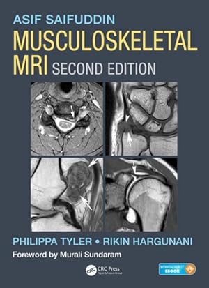 Image du vendeur pour Musculoskeletal MRI mis en vente par GreatBookPricesUK