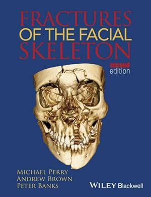 Image du vendeur pour Fractures of the Facial Skeleton mis en vente par GreatBookPricesUK