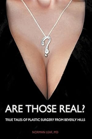 Bild des Verkufers fr Are Those Real? : True Tales of Plastic Surgery from Beverly Hills zum Verkauf von GreatBookPricesUK