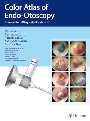 Bild des Verkufers fr Color Atlas of Endo-Otoscopy : Examination-Diagnosis-Treatment zum Verkauf von GreatBookPricesUK