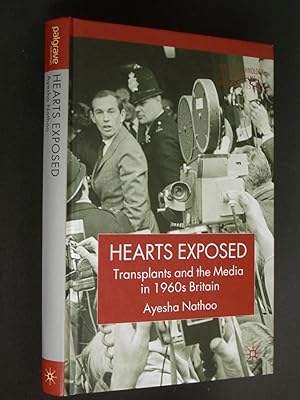 Hearts Exposed: Transplants and the Media in 1960s Britain