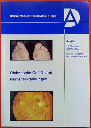 Seller image for Diabetische Gef- und Nervenerkrankungen. Band 36. 18. Diabetes-Seminar 2000. Diabetes-Akademie Bad Mergentheim e.V. 1. Auflage. for sale by biblion2