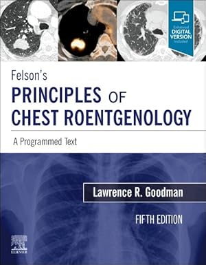 Bild des Verkufers fr Felson's Principles of Chest Roentgenology : A Programmed Text zum Verkauf von GreatBookPrices