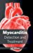 Seller image for Myocarditis: Detection and Treatment [Hardcover ] for sale by booksXpress