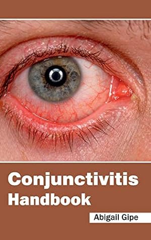 Seller image for Conjunctivitis Handbook [Hardcover ] for sale by booksXpress