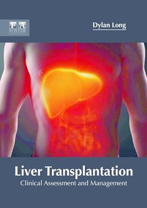 Seller image for Liver Transplantation: Clinical Assessment and Management [Hardcover ] for sale by booksXpress