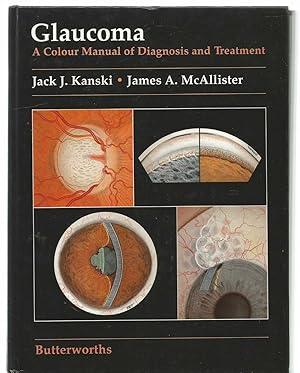 Glaucoma - A Colour manual of Diagnosis and treatment