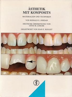 Ästhetik mit Komposits: Materialien und Techniken. Unter Mitarb. v. L. Boksman, I. Comfortes, N.L...