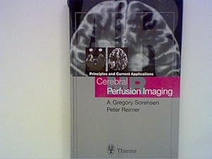 Bild des Verkufers fr Cerebral MR Perfusion Imaging: Book + CD-ROM Set: Principles and Current Applications zum Verkauf von ANTIQUARIAT FRDEBUCH Inh.Michael Simon