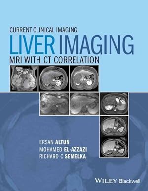 Seller image for Liver Imaging : MRI With CT Correlation for sale by GreatBookPricesUK