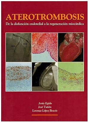 Imagen del vendedor de ATEROTROMBOSIS. DE LA DISFUNCIN ENDOTELIAL A LA REGENERACIN MIOCRDICA a la venta por Librera Dilogo