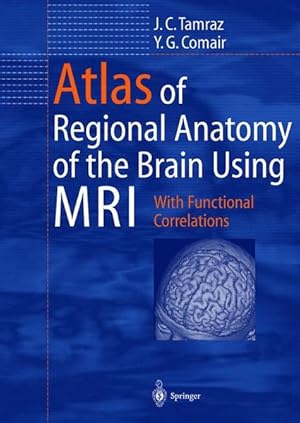 Image du vendeur pour Atlas of Regional Anatomy of the Brain Using MRI: With Functional Correlations. mis en vente par Wissenschaftl. Antiquariat Th. Haker e.K