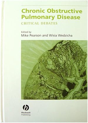 Seller image for Chronic Obstructive Pulmonary Disease: Critical Debates for sale by PsychoBabel & Skoob Books