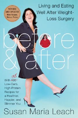 Seller image for Before & After: Living and Eating Well After Weight-Loss Surgery (Paperback or Softback) for sale by BargainBookStores