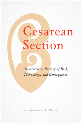 Seller image for Cesarean Section: An American History of Risk, Technology, and Consequence (Paperback or Softback) for sale by BargainBookStores