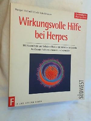 Wirkungsvolle Hilfe bei Herpes : mit Hausmitteln und Selbstmedikation die Infektion behandeln ; a...