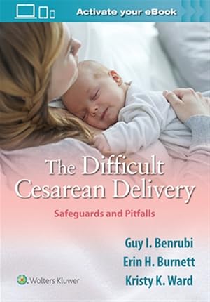 Seller image for Difficult Cesarean Delivery : Safeguards and Pitfalls for sale by GreatBookPricesUK
