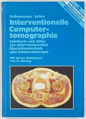 Interventionelle Computertomographie. Lehrbuch und Atlas zur Interventionellen Operationstechnik ...