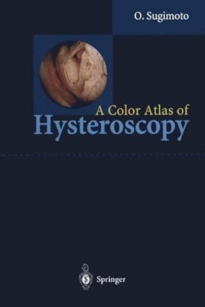 Imagen del vendedor de Color Atlas of Hysteroscopy a la venta por GreatBookPrices