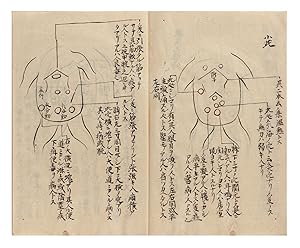 Illustrated manuscript on paper, entitled on upper wrapper "Murai sensei fukukoben" ["Abdominal D...